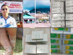 Tanggapi Lonjakan Kasus Skabies di Puncak Jaya, Dinkes Papua Tengah Menerjunkan Tim Medis dan Bantuan Obat